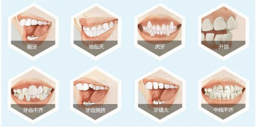 做烤瓷牙跟牙齿矫正什么好(做烤瓷牙跟牙齿矫正什么好点)(图1)